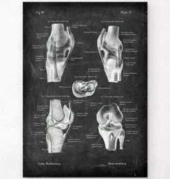 Anatomie du genou II - Chalkboard-Codex Anatomicus Clearance