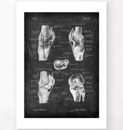 Anatomie du genou II - Chalkboard-Codex Anatomicus Clearance