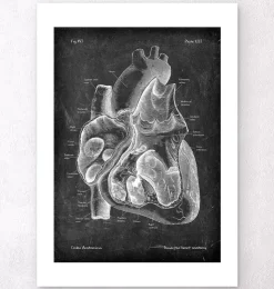 Dissected heart anatomy II - Chalkboard-Codex Anatomicus Clearance