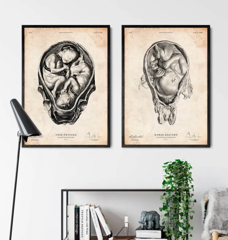 Foetus dans un utérus-Codex Anatomicus Best