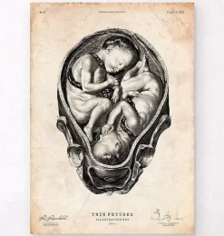 Foetus II-Codex Anatomicus Online