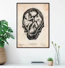 Foetus II-Codex Anatomicus Online