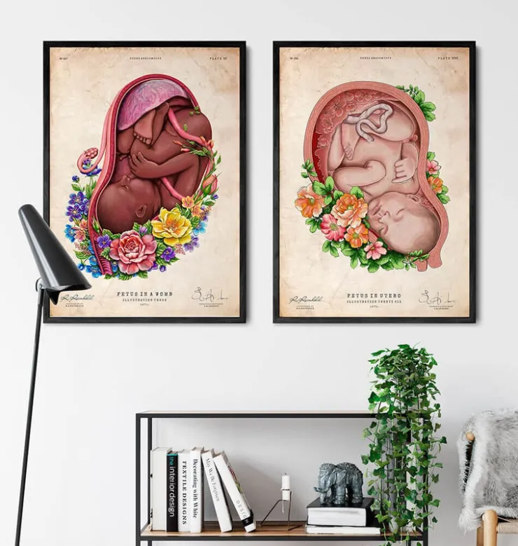 Foetus in a utérus II - Vieux papier-Codex Anatomicus New