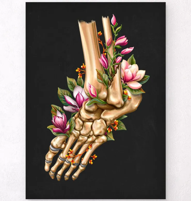 Fracture de la cheville - Floral - Noir-Codex Anatomicus New