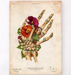 Fracture du poignet - Floral - Vintage-Codex Anatomicus New