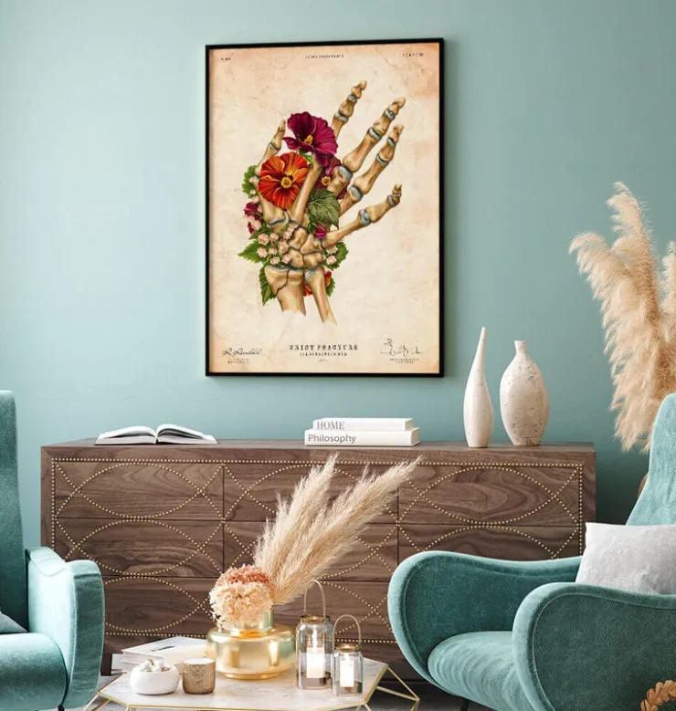 Fracture du poignet - Floral - Vintage-Codex Anatomicus New