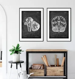 Medulla oblongata - Chalkboard-Codex Anatomicus Outlet
