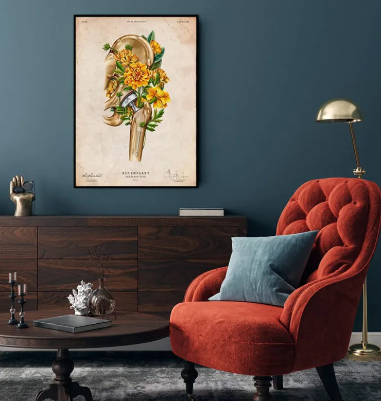 Prothèse totale de hanche - Floral - Vintage-Codex Anatomicus