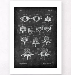 Types de vertèbres - Chalkboard-Codex Anatomicus Discount